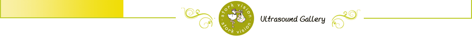 Stork Vision&reg; Ultrasound Gallery