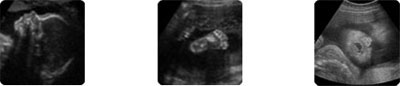 StorkVision 2D Ultrasound images